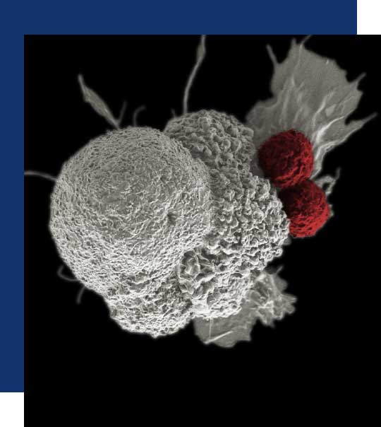 Immunotherapy treatment for mesothelioma