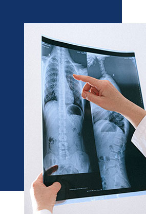 Doctor checking X-ray for asbestos lung cancer diagnosis